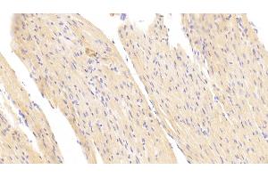 Immunohistochemistry (IHC) image for anti-Succinate Dehydrogenase Complex, Subunit B, Iron Sulfur (Ip) (SDHB) (AA 97-282) antibody (ABIN7441589)