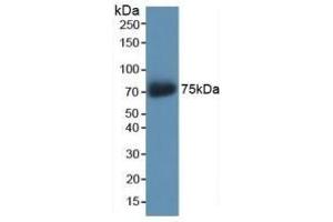 Detection of Recombinant AKAP11, Human using Polyclonal Antibody to A Kinase Anchor Protein 11 (AKAP11) (AKAP11 抗体  (AA 1650-1901))