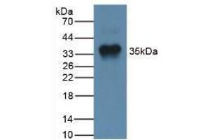 Western blot analysis of Human Liver Tissue. (MSTN 抗体  (AA 266-375))