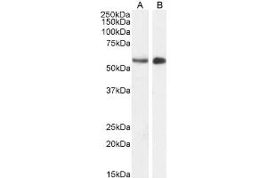 ABIN185178 (1µg/ml) staining of Mouse (A) and (2ug/ml) Pig (B) Testes lysate (35µg protein in RIPA buffer). (STK35 抗体  (C-Term))