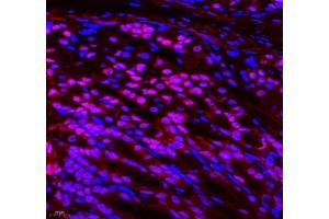 Immunofluorescence of paraffin embedded mouse stomach using MECOM (ABIN7074575) at dilution of 1: 700 (400x lens) (MECOM 抗体)