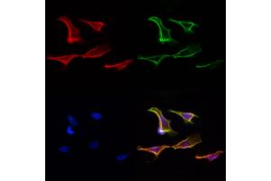 ABIN6265225 and ABIN6277101 staining Hela cells by IF/ICC. (SORD 抗体  (Internal Region))