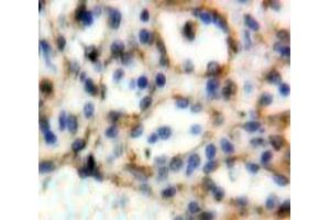 Used in DAB staining on fromalin fixed paraffin-embedded Spleen tissue (CD72 抗体  (AA 169-359))