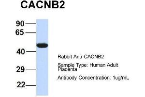 Western Blotting (WB) image for anti-Calcium Channel, Voltage-Dependent, beta 4 Subunit (CACNB4) (Middle Region) antibody (ABIN2774681)