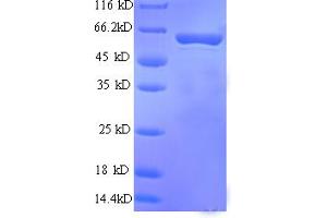 SDS-PAGE (SDS) image for Fatty Acid Binding Protein 9, Testis (FABP9) (AA 25-554), (partial) protein (His tag) (ABIN5710143) (FABP9 Protein (AA 25-554, partial) (His tag))