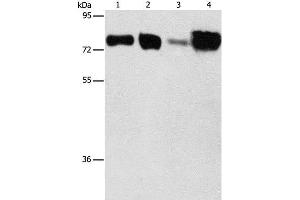 Western Blot analysis of Hepg2 and hela cell, Human fetal kidney and liver tissue using ACSL4 Polyclonal Antibody at dilution of 1:650 (ACSL4 抗体)