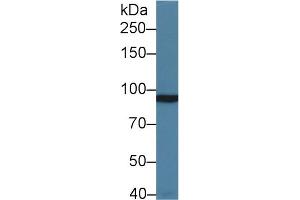 Western Blot; Sample: Rat Cerebrum lysate; Primary Ab: 1µg/ml Rabbit Anti-Human GRM3 Antibody Second Ab: 0. (Metabotropic Glutamate Receptor 3 抗体  (AA 568-819))