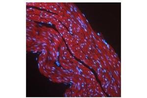 IGF1R antibody used at a concentration of 2-10 ug/ml to detect mouse skeletal muscle (red). (IGF1R 抗体  (Middle Region))