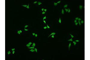 Immunofluorescence staining of HepG2 cells with ABIN7161520 at 1:100, counter-stained with DAPI. (NFKBIA 抗体  (AA 27-317))