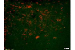 Formalin-fixed and paraffin-embedded rat brain labeled with Anti-Ninein/GSK3B interacting protein Polyclonal Antibody, Unconjugated (ABIN872552) 1:200, overnight at 4°C, The secondary antibody was Goat Anti-Rabbit IgG, Cy3 conjugated used at 1:200 dilution for 40 minutes at 37°C. (GSKIP 抗体  (AA 133-230))