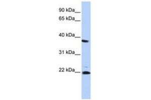 Image no. 1 for anti-Proteasome (Prosome, Macropain) Subunit, beta Type 2 (PSMB2) (AA 107-156) antibody (ABIN6741387)
