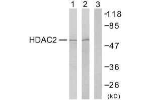Western blot analysis of extracts from HeLa cells (Lane 1) and 293 cells (Lane 2 and 3), using HDAC2 (Ab-394) antibody (E021140). (HDAC2 抗体)