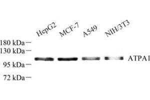 Western blot analysis of Sodium Potassium (ABIN7073154) at dilution of 1: 500 (ATPase (Na/K) 抗体)