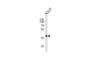Western blot analysis of lysate from NCCIT cell line, using SOX2 Antibody (ABIN387798 and ABIN2843854). (SOX2 抗体)