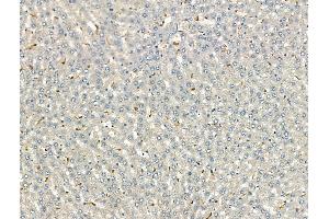 ABIN7093170 and ABIN7098475 at 1/100 staining Rat liver tissue by IHC-P. (C3 抗体)