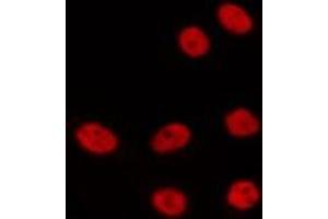 ABIN6275329 staining HepG2 by IF/ICC. (NOLC1 抗体  (C-Term))