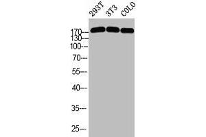 Western blot analysis of 293T 3T3 COLO using p-Topo IIα (S1525) antibody. (Topoisomerase II alpha 抗体  (pSer1525))