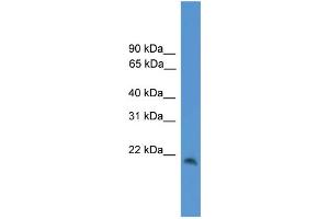 WB Suggested Anti-CBLN1 Antibody Titration: 0. (CBLN1 抗体  (C-Term))