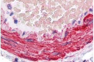 Immunohistochemistry (Formalin-fixed Paraffin-embedded Sections) (IHC (fp)) image for anti-Low Density Lipoprotein Receptor Adaptor Protein 1 (LDLRAP1) (AA 1-264) antibody (ABIN574448)