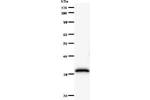 Western Blotting (WB) image for anti-F-Box and Leucine-Rich Repeat Protein 4 (FBXL4) antibody (ABIN931099) (FBXL4 抗体)