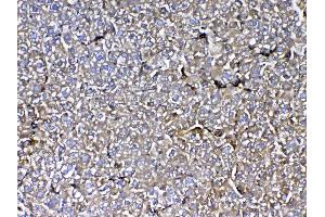 IHC analysis of MBL2 using anti-MBL2 antibody . (MBL2 抗体  (AA 19-244))