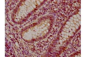 Immunohistochemistry (IHC) image for anti-Sulfotransferase Family, Cytosolic, 1A, Phenol-Preferring, Member 2 (SULT1A2) (AA 195-284) antibody (ABIN7170949)