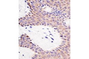 Immunohistochemistry (Paraffin-embedded Sections) (IHC (p)) image for anti-Kinesin Family Member 22 (KIF22) (AA 423-456) antibody (ABIN6242941)