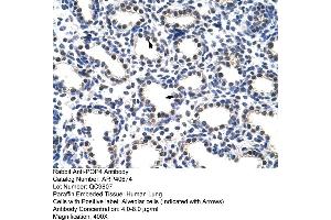 Rabbit Anti-POP4 Antibody  Paraffin Embedded Tissue: Human Lung Cellular Data: Alveolar cells Antibody Concentration: 4. (RPP29 抗体  (C-Term))