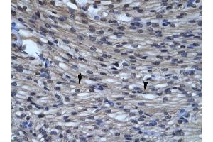 CLIC5 antibody was used for immunohistochemistry at a concentration of 4-8 ug/ml to stain Myocardial cells (arrows) in Human Heart. (CLIC5 抗体  (C-Term))