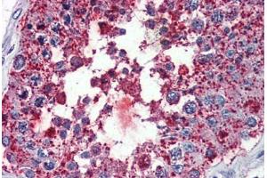 Testis, Human: Formalin-Fixed, Paraffin-Embedded (FFPE) (Bestrophin 3 抗体  (Cytoplasmic Domain))