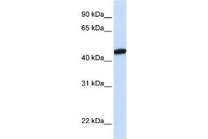 WB Suggested Anti-KRR1 Antibody Titration:  0. (KRR1 抗体  (C-Term))