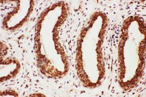 Anti-MAG antibody, IHC(P) IHC(P): Human Mammary Cancer Tissue