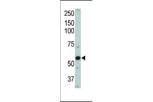 Western Blotting (WB) image for anti-Activin A Receptor Type II-Like 1 (ACVRL1) (AA 38-68), (N-Term) antibody (ABIN392241)