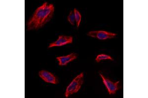 ABIN6263228 and ABIN6273139 staining Hela by IF/ICC. (MEST 抗体  (C-Term))