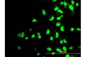 Immunofluorescence of monoclonal antibody to POLR1C on HeLa cell.