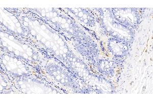 Detection of IL17 in Canine Colon Tissue using Polyclonal Antibody to Interleukin 17 (IL17) (IL-17 抗体  (AA 1-155))