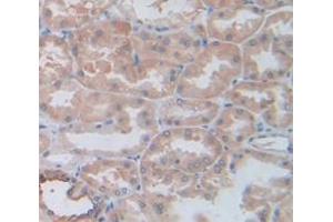 IHC-P analysis of Human Tissue, with DAB staining. (L1CAM 抗体  (AA 526-690))
