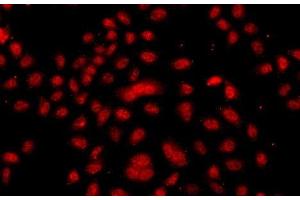 Immunofluorescence analysis of A549 cells using FBXW11 Polyclonal Antibody (FBXW11 抗体)