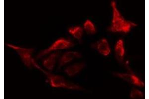 ABIN6278656 staining HepG2 cells by IF/ICC. (OXSR1 抗体  (pThr185))