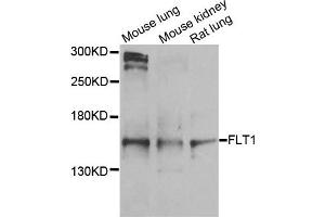Western blot analysis of extracts of various cells, using FLT1 antibody. (FLT1 抗体)