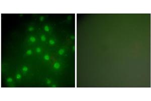 Immunofluorescence analysis of HepG2 cells, using HDAC9 antibody (ABIN5976425). (HDAC9 抗体  (C-Term))