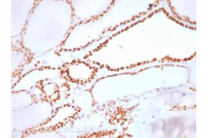 Formalin-fixed, paraffin-embedded human Thyroid stained with TTF-1 Rabbit Recombinant Monoclonal Antibody (NX2. (Recombinant NKX2-1 抗体)