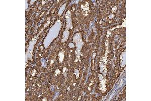 IHC analysis of SBP/SELENBP1 using anti-SBP/SELENBP1 antibody (ABIN7600755). (SELENBP1 抗体  (AA 23-462))