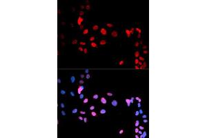 Immunofluorescent staining of U-2 OS cells with MAX (phospho S11) polyclonal antibody  at 1:50-1:200 dilution. (MAX 抗体  (pSer11))