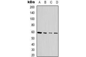 Western blot analysis of SEN54 expression in MCF7 (A), Jurkat (B), HEK293T (C), NIH3T3 (D) whole cell lysates. (TSEN54 抗体)