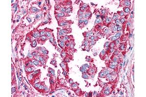 Immunohistochemistry (IHC) image for anti-Wingless-Type MMTV Integration Site Family, Member 5B (WNT5B) (Internal Region) antibody (ABIN1049479)