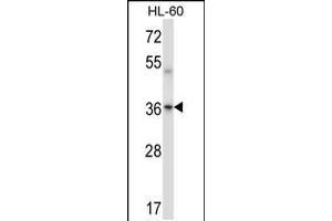 Western blot analysis in HL-60 cell line lysates (35ug/lane). (PRKACA/PRKACB 抗体  (C-Term))