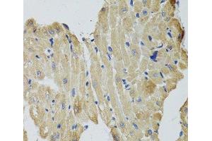 Immunohistochemistry of paraffin-embedded Rat heart using CKMT2 Polyclonal Antibody at dilution of 1:100 (40x lens). (CKMT2 抗体)