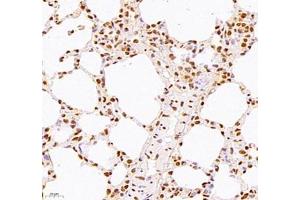 Immunohistochemistry of paraffin embedded mouse lung using WDR13 (ABIN7076212) at dilution of 1: 2500 (400x lens) (WDR13 抗体)