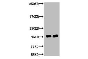 Western blot analysis of 1) Hela, 2) 293T, diluted at 1:2000. (ABCB5 抗体)